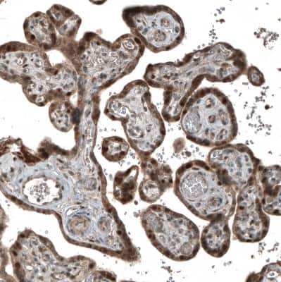 Immunohistochemistry-Paraffin: CDK2 Antibody (CL7990) [NBP2-88911]