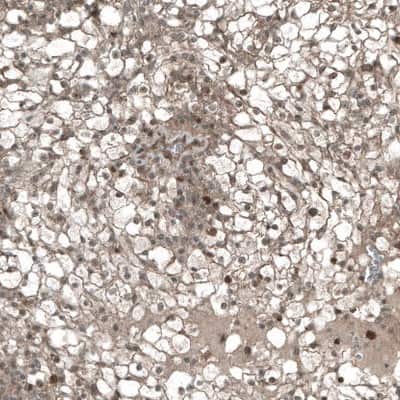 Immunohistochemistry-Paraffin: CDK2 Antibody (CL7990) [NBP2-88911]