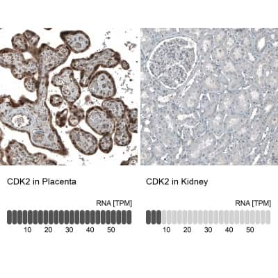 Immunohistochemistry-Paraffin: CDK2 Antibody (CL7990) [NBP2-88911]