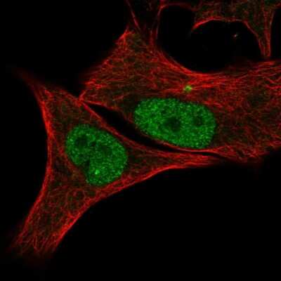 Immunocytochemistry/ Immunofluorescence: CDK2 Antibody [NBP2-57327]