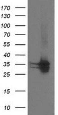 Western Blot: CDK2 Antibody (OTI2D9)Azide and BSA Free [NBP2-70392]