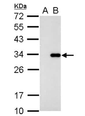 Western Blot: CDK2 Antibody [NBP2-15841]