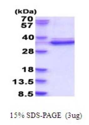 SDS-PAGE: Recombinant Human CDK2 His Protein [NBP2-51887]