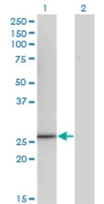 Western Blot: CDK20 Antibody (3E11) [H00023552-M13]