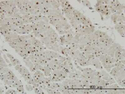 Immunohistochemistry-Paraffin: CDK20 Antibody (4D6) [H00023552-M02]