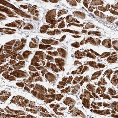 Immunohistochemistry-Paraffin: CDK20 Antibody [NBP1-91213]