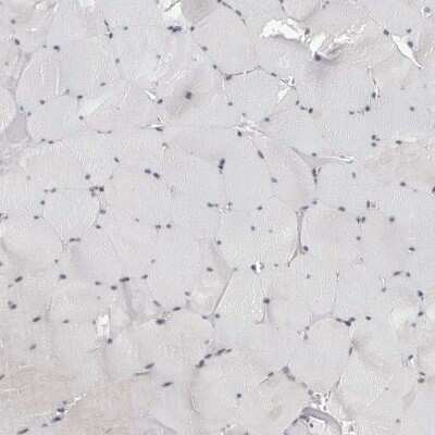 Immunohistochemistry-Paraffin: CDK20 Antibody [NBP1-91214]