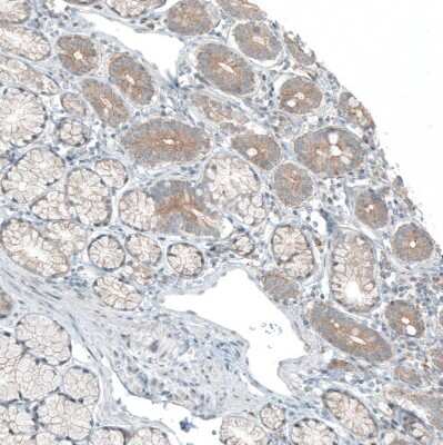 Immunohistochemistry-Paraffin: CDK20 Antibody [NBP1-91214]
