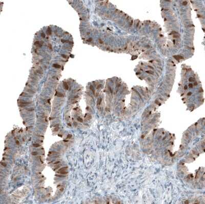 Immunohistochemistry-Paraffin: CDK20 Antibody [NBP1-91214]