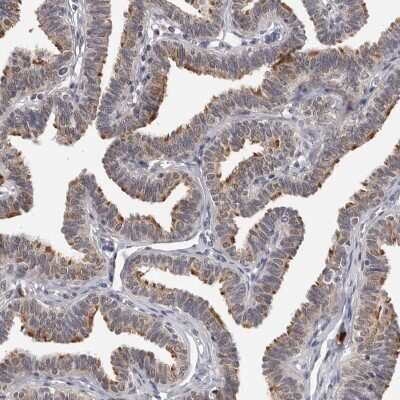 Immunohistochemistry-Paraffin: CDK20 Antibody [NBP1-91215]
