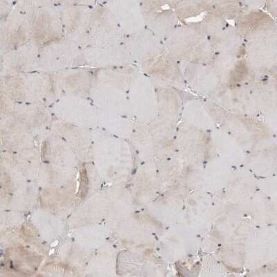 Immunohistochemistry-Paraffin: CDK20 Antibody [NBP1-91215]