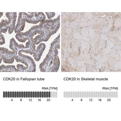 Immunohistochemistry-Paraffin: CDK20 Antibody [NBP1-91215]