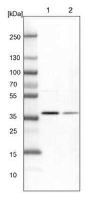 Western Blot: CDK20 Antibody [NBP1-91214]
