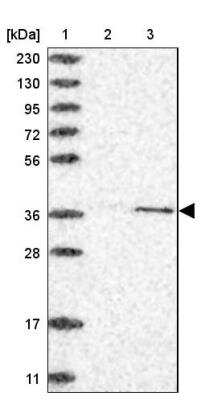 Western Blot: CDK20 Antibody [NBP1-91214]