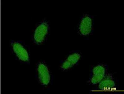 Immunocytochemistry/ Immunofluorescence: CDK2AP1 Antibody [H00008099-B01P-50ug]