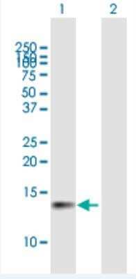 Western Blot: CDK2AP1 Antibody [H00008099-B01P-50ug]