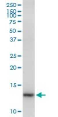 Western Blot: CDK2AP2 Antibody [H00010263-B01P]