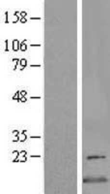 Western Blot: CDK2AP2 Overexpression Lysate [NBL1-09038]