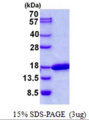 SDS-PAGE: Recombinant Human CDK2AP2 His Protein [NBP2-22972]