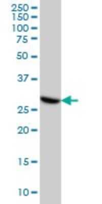Western Blot: CDK4 Antibody (2G7) [H00001019-M04]