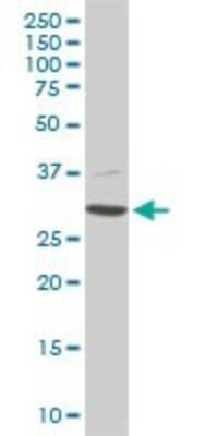 Western Blot: CDK4 Antibody (2G7) [H00001019-M04]