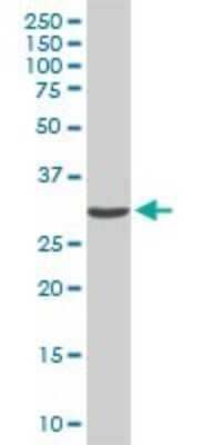 Western Blot: CDK4 Antibody (2G7) [H00001019-M04]