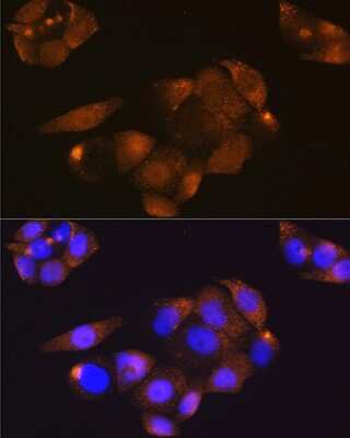 Immunocytochemistry/ Immunofluorescence: CDK4 Antibody (6N3M6) [NBP3-15344]