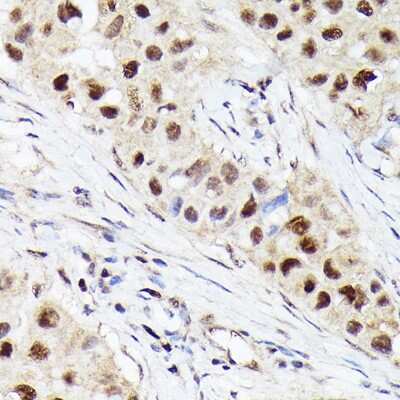 Immunohistochemistry-Paraffin: CDK4 Antibody (6N3M6) [NBP3-15344]