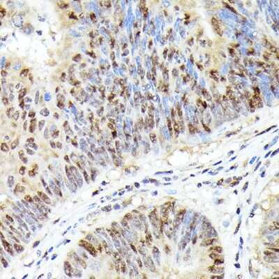Immunohistochemistry-Paraffin: CDK4 Antibody (6N3M6) [NBP3-15344]