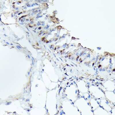 Immunohistochemistry-Paraffin: CDK4 Antibody (6N3M6) [NBP3-15344]