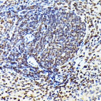 Immunohistochemistry-Paraffin: CDK4 Antibody (6N3M6) [NBP3-15344]