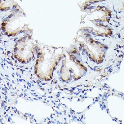 Immunohistochemistry-Paraffin: CDK4 Antibody (6N3M6) [NBP3-15344]