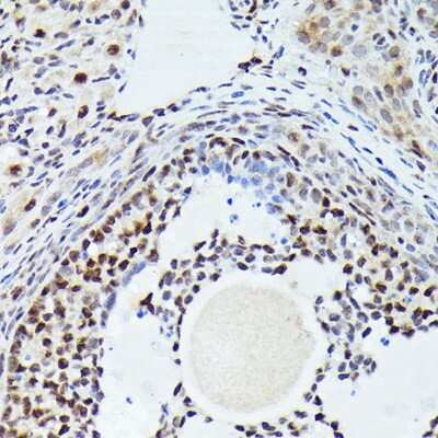 Immunohistochemistry-Paraffin: CDK4 Antibody (6N3M6) [NBP3-15344]