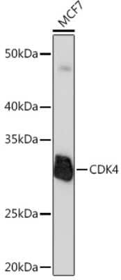 Western Blot: CDK4 Antibody (6N3M6) [NBP3-15344]