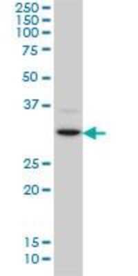 Western Blot: CDK4 Antibody (4F11) [H00001019-M03]