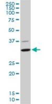 Western Blot: CDK4 Antibody (4F11) [H00001019-M03]