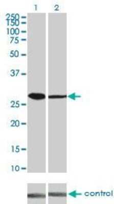 Western Blot: CDK4 Antibody (4F11) [H00001019-M03]