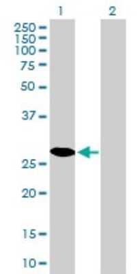 Western Blot: CDK4 Antibody (4F11) [H00001019-M03]