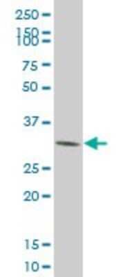 Western Blot: CDK4 Antibody (8A10) [H00001019-M09]