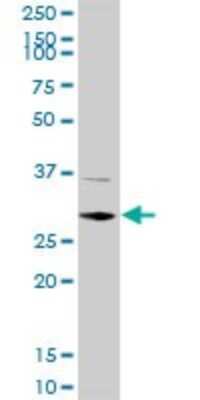 Western Blot: CDK4 Antibody (8A10) [H00001019-M09]
