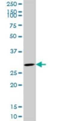 Western Blot: CDK4 Antibody (8A10) [H00001019-M09]