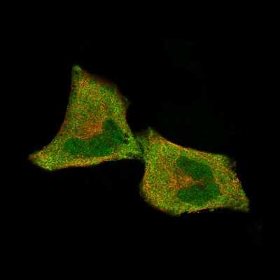 Immunocytochemistry/ Immunofluorescence: CDK4 Antibody (CL8102) [NBP2-88912]