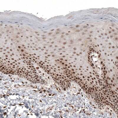 Immunohistochemistry-Paraffin: CDK4 Antibody (CL8102) [NBP2-88912]