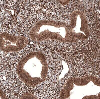Immunohistochemistry-Paraffin: CDK4 Antibody (CL8102) [NBP2-88912]