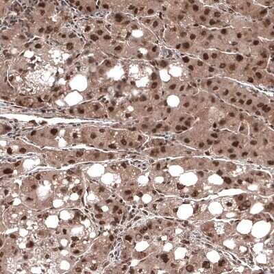 Immunohistochemistry-Paraffin: CDK4 Antibody (CL8102) [NBP2-88912]