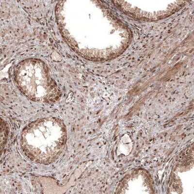 Immunohistochemistry-Paraffin: CDK4 Antibody (CL8102) [NBP2-88912]
