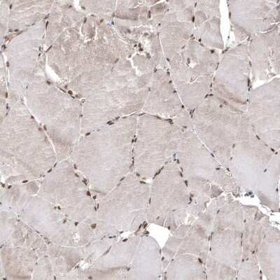 Immunohistochemistry-Paraffin: CDK4 Antibody (CL8102) [NBP2-88912]