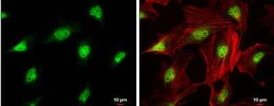 Immunocytochemistry/ Immunofluorescence: CDK4 Antibody [NBP1-31308]