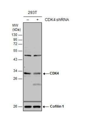 Western Blot: CDK4 Antibody [NBP1-31308]