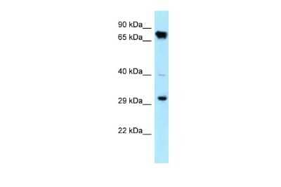 Western Blot: CDK4 Antibody [NBP2-32288]